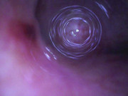 Fiberscope in urethral test tube