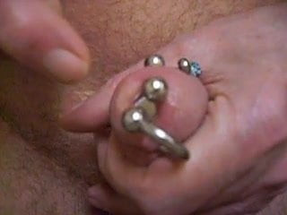 insertion of a 5 stage ( 6-7.5-9-10.5-12.5 ) mm sound