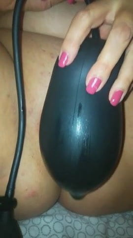 Pussy huge dilatation