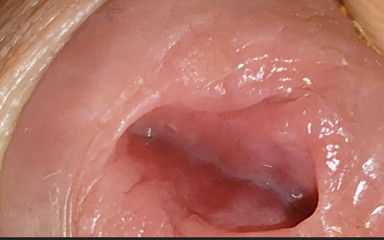 Extreme Close up of Stepdaddy's Widened Hole Rough.
