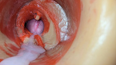 Female Insemination - Internal Camera Captures Deep Male Huge Ejaculation