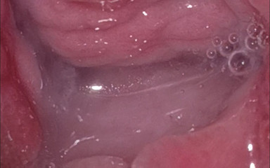 /beam/xhD4og9