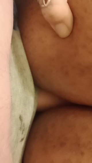 Anal