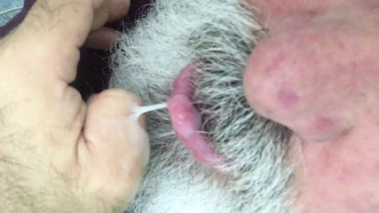 MY BIGGEST MAJOR PENIS MACRO-PENIS WORLD