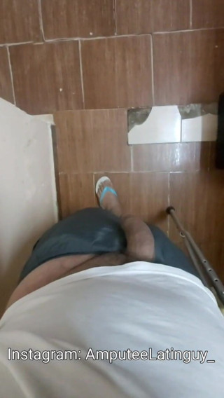 amputee walking with the penis outside