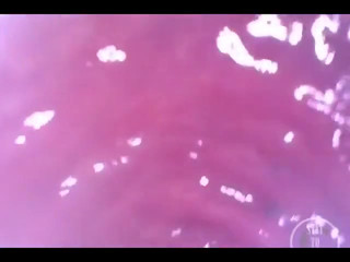 POV Extreme Deep Anal Examination! thumbnail