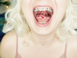 BRACES fetish: ASMR video of eating MUKBANG..