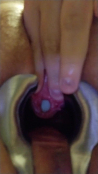 Urethral sound exiting pisshole