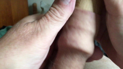 Foreskin with bat and pin - 2 of 2