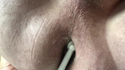 Cleaning my ring