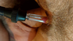 Clit pumping 218