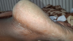 The Pig Has Big Legs and Asked a Cuckold to Come Lick the Cuckold Album Available There