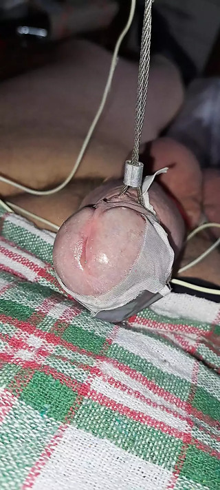 Electro estim Solo cum