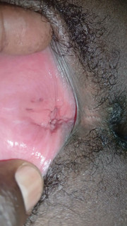 Teen pussy lips opened up.(18+)