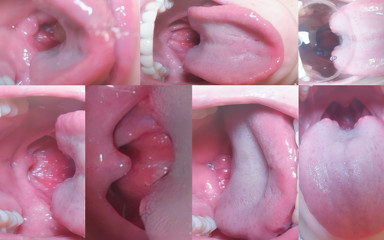 Tonguefetish Gagreflex Salivaspit Throattraining Chinesegirlslave
