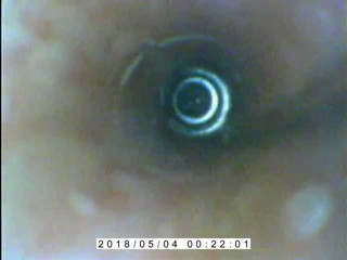 endoscope peehole cumflow