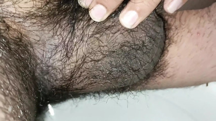 I'm very itchy from my hair.
