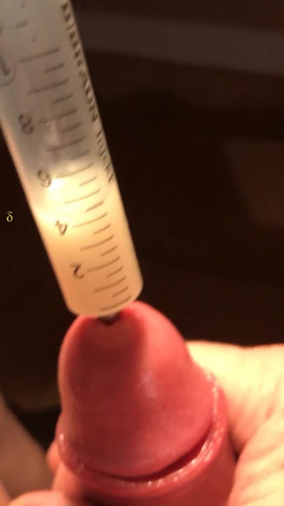 ADelta Cum collection in Syringe with Urethra plug