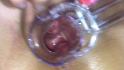 Asked my friend to film me with speculum masturbating orgasm