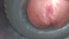 Internal view: vulva twitching and ejaculating 6