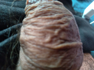 Amazing wrinkled foreskin