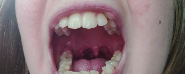 Throat Fetish