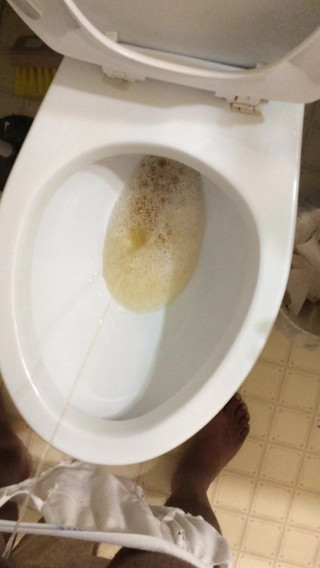 Peeing
